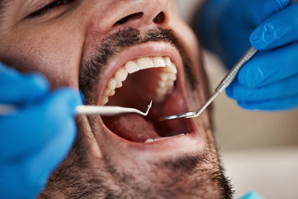 Best Pediatric Emergency Dentist in Gregory, SD